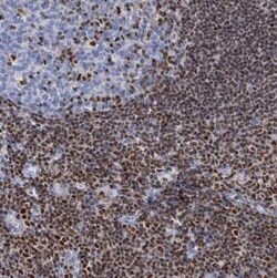 CUGBP2 Antibody, Novus Biologicals:Antibodies:Primary Antibodies