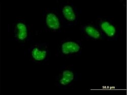 CUTC Antibody, Novus Biologicals 0.05 mg | Buy Online | Novus Biologicals | Fisher Scientific