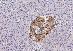CX3CL1/Fractalkine Rabbit anti-Human, Clone: 409, Novus Biologicals:Antibodies:Primary