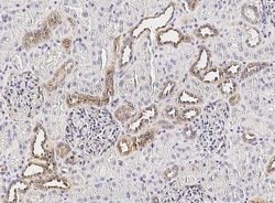 CX3CL1/Fractalkine Rabbit anti-Human, Clone: 409, Novus Biologicals:Antibodies:Primary