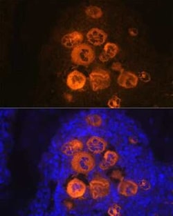 CXCL4/PF4 Rabbit anti-Human, Mouse, Rat, Clone: 6Q10H2, Novus Biologicals