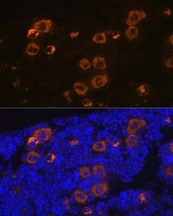 CXCL4/PF4 Rabbit anti-Human, Mouse, Rat, Clone: 6Q10H2, Novus Biologicals