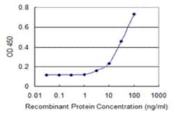 Novus Biologicals CXCL6/GCP-2 Antibody (2G12), Novus Biologicals 0.1 mg | Buy Online | Novus Biologicals&trade; | Fisher Scientific