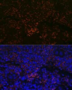 CXCR3 Rabbit anti-Human, Mouse, Rat, Clone: 3B7Y7, Novus Biologicals 20