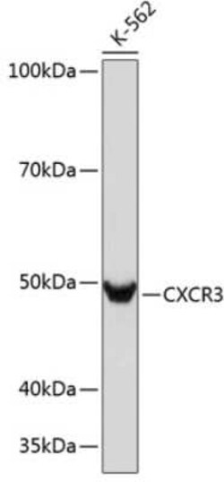 CXCR3 Rabbit anti-Human, Mouse, Rat, Clone: 3B7Y7, Novus Biologicals 20