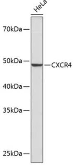 CXCR4 Rabbit anti-Human, Clone: 9B6G1, Novus Biologicals 100 &mu;g; Unconjugated:Antibodies,