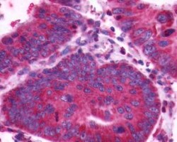 CXCR4 Antibody - BSA Free, Novus Biologicals 0.05 mL, Unconjugated:Antibodies,