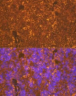 CXCR5 Rabbit anti-Human, Mouse, Rat, Clone: 9Q10I2, Novus Biologicals 100 &mu;g | Buy Online | Novus Biologicals | Fisher Scientific