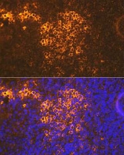 CXCR5 Rabbit anti-Human, Mouse, Rat, Clone: 9Q10I2, Novus Biologicals 100 &mu;g | Buy Online | Novus Biologicals | Fisher Scientific