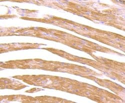 CXCR5 Antibody (JB11-40), Novus Biologicals 100 &mu;l; Unconjugated:Antibodies,