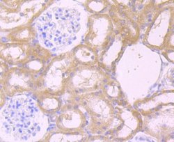 CXCR5 Antibody (JB11-40), Novus Biologicals 100 &mu;l; Unconjugated:Antibodies,