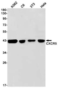 CXCR5 Rabbit anti-Human, Mouse, Rat, Clone: S03-8K7, Novus Biologicals 100 &mu;g | Buy Online | Novus Biologicals | Fisher Scientific