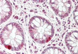 CXXC1 Rabbit anti-Human, Polyclonal, Novus Biologicals 0.1ml; Unconjugated:Antibodies,