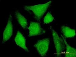 CXorf21 Antibody, Novus Biologicals 50 &mu;g | Buy Online | Novus Biologicals | Fisher Scientific