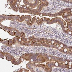 CXorf40A Antibody, Novus Biologicals 25 &mu;L, Unconjugated:Antibodies,