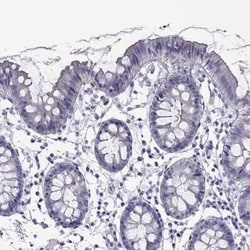 PIH1D3 Antibody, Novus Biologicals 25 &mu;L | Buy Online | Novus Biologicals | Fisher Scientific