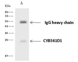 CYB561D1 Antibody, Novus Biologicals 100 &mu;g, Unconjugated:Antibodies,