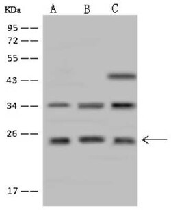 CYB561D1 Antibody, Novus Biologicals 100 &mu;g, Unconjugated:Antibodies,