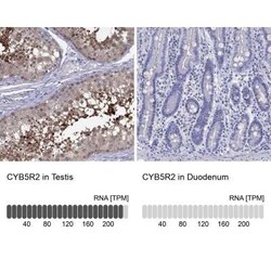 CYB5R2 Antibody, Novus Biologicals 100 &mu;g; Unconjugated:Antibodies,