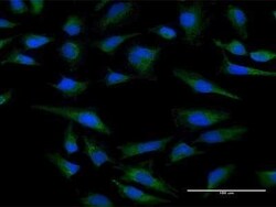 CYC1 Antibody, Novus Biologicals 0.05 mg | Buy Online | Novus Biologicals | Fisher Scientific