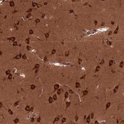 CYFIP1 Antibody, Novus Biologicals:Antibodies:Primary Antibodies