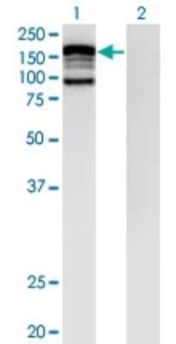 CYLN2 Antibody (3H5), Novus Biologicals 0.1 mg | Buy Online | Novus Biologicals | Fisher Scientific