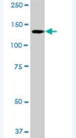 Novus Biologicals CYLN2 Antibody, Novus Biologicals 50 &mu;g | Buy Online | Novus Biologicals&trade; | Fisher Scientific