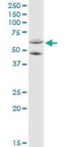 CYP11A1 Antibody, Novus Biologicals 0.1 mg | Buy Online | Novus Biologicals | Fisher Scientific