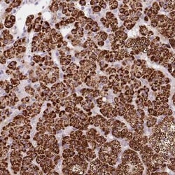 CYP11B1 Antibody, Novus Biologicals:Antibodies:Primary Antibodies