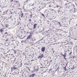 CYP11B1 Antibody, Novus Biologicals:Antibodies:Primary Antibodies