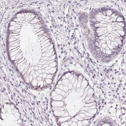 CYP11B1 Antibody, Novus Biologicals:Antibodies:Primary Antibodies
