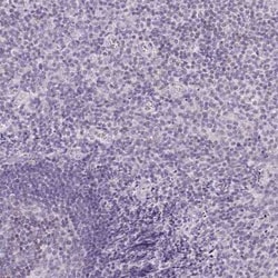 CYP11B1 Antibody, Novus Biologicals:Antibodies:Primary Antibodies