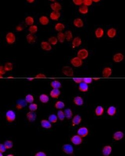 CYP11B2 Antibody - BSA Free, Novus Biologicals 0.1 mL, Unconjugated:Antibodies,
