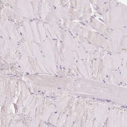CYP11B2 Antibody, Novus Biologicals:Antibodies:Primary Antibodies