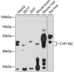 CYP11B2 Antibody - BSA Free, Novus Biologicals 0.1 mL, Unconjugated:Antibodies,