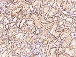 CYP1B1 Antibody, Novus Biologicals 100 &mu;g, Unconjugated:Antibodies,