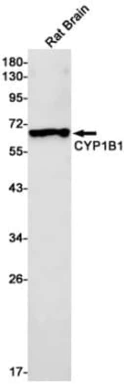 CYP1B1 Antibody (S02-5A3), Novus Biologicals:Antibodies:Primary Antibodies