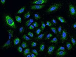 CYP24A1 Antibody, Novus Biologicals:Antibodies:Primary Antibodies