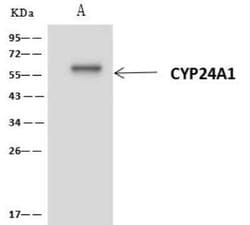 CYP24A1 Antibody, Novus Biologicals:Antibodies:Primary Antibodies