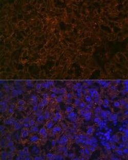 CYP26A1 Rabbit anti-Human, Mouse, Rat, Clone: 1E1D2, Novus Biologicals:Antibodies:Primary