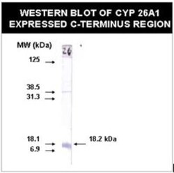 CYP26A1 Antibody (F27P6A1) - BSA Free, Novus Biologicals 0.025 mL, Unconjugated:Antibodies,