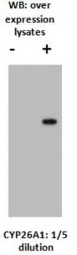 CYP26A1 Antibody (F27P6A1) - BSA Free, Novus Biologicals 0.025 mL, Unconjugated:Antibodies,