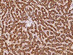 CYP2A13 Antibody, Novus Biologicals 50 &mu;g; Unconjugated:Antibodies,