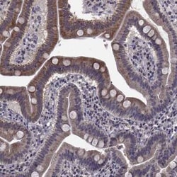 CYP2S1 Antibody, Novus Biologicals 25 &mu;L | Buy Online | Novus Biologicals | Fisher Scientific