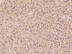 CYP39A1 Antibody, Novus Biologicals 100 &mu;g | Buy Online | Novus Biologicals | Fisher Scientific