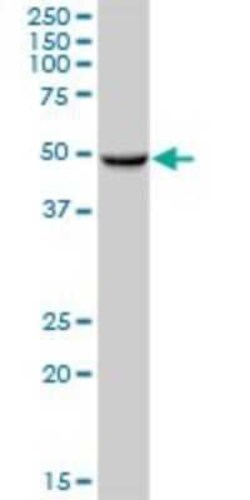 CYP3A43 Antibody, Novus Biologicals 50 &mu;g; Unconjugated:Antibodies,