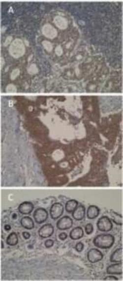 CYP46A1 Antibody (N8-P6E4 H8) - BSA Free, Novus Biologicals:Antibodies:Primary