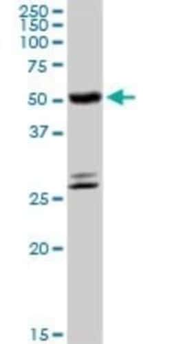 CYP4B1 Antibody, Novus Biologicals 0.1 mg | Buy Online | Novus Biologicals | Fisher Scientific