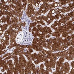 CYP4F2 Antibody, Novus Biologicals 25 &mu;L, Unconjugated:Antibodies, Polyclonal