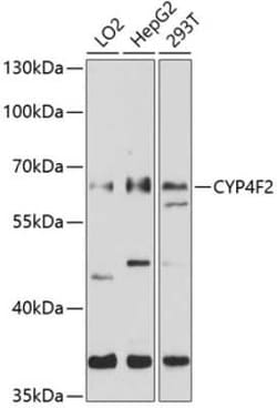 CYP4F2 Antibody - BSA Free, Novus Biologicals 0.02 mL | Buy Online | Novus Biologicals | Fisher Scientific